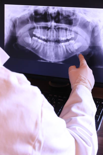Best Emergency Wisdom Tooth Extraction in Osseo, WI